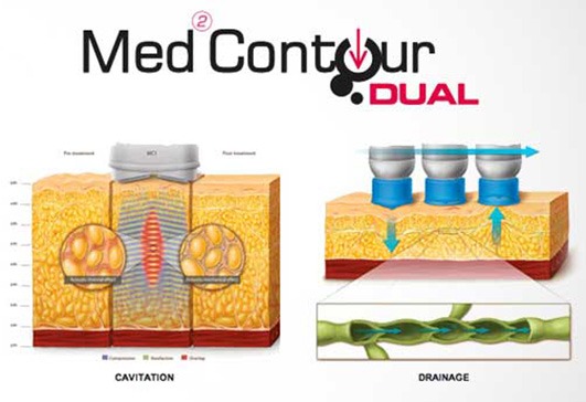 skin tightening medical diagram cropped